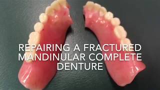 Repairing a fractured denture [upl. by Compton]