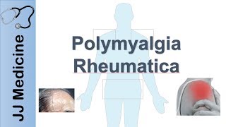 EXTRAPYRAMIDAL SYMPTOMS EPSs Mental Health Nursing [upl. by Ahseinar]