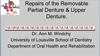 Repairs to the Removable Partial Denture [upl. by Eanram934]