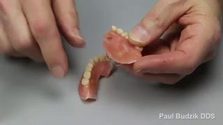 How to Repair Broken Denture [upl. by Lurie]