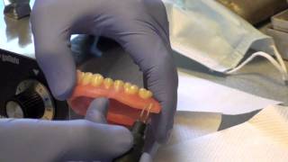 Denture Soft Reline Part 2 [upl. by Notsle]