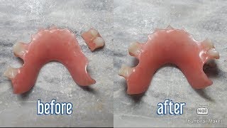 How to fix a broken denture [upl. by Slayton]