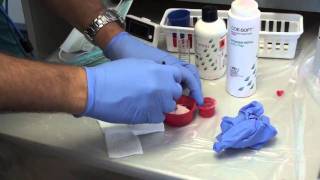 Denture Soft Reline Part 1 [upl. by Turnbull]