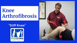 How to Treat an Arthrofibrotic Knee in Physical Therapy [upl. by Fen]