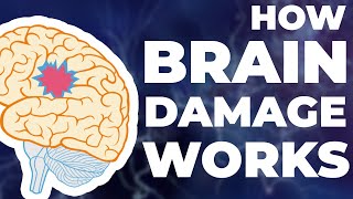 How Brain Damage Works [upl. by Ilysa381]