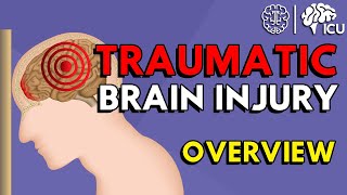 Overview of Traumatic Brain Injury TBI [upl. by Pihc]