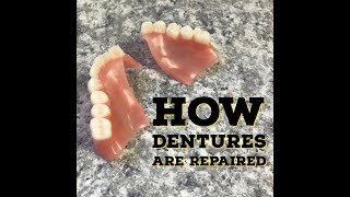 How Dentures Are RepairedFixed [upl. by Ettenav]