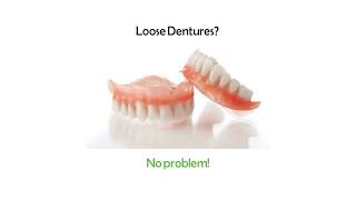 Denture Reline Kit  Perma Laboaratories [upl. by Barbara]