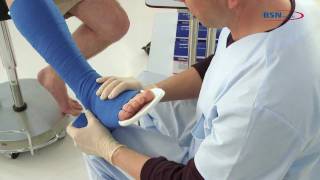 Synthetic splinting reinforced posterior leg splintENby BSN medical [upl. by Egidio]