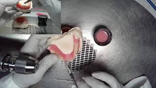 Denture Base Fracture Repair [upl. by Atlee]