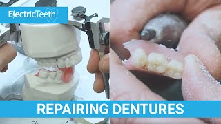 Repairing broken dentures amp false teeth [upl. by Inalan]